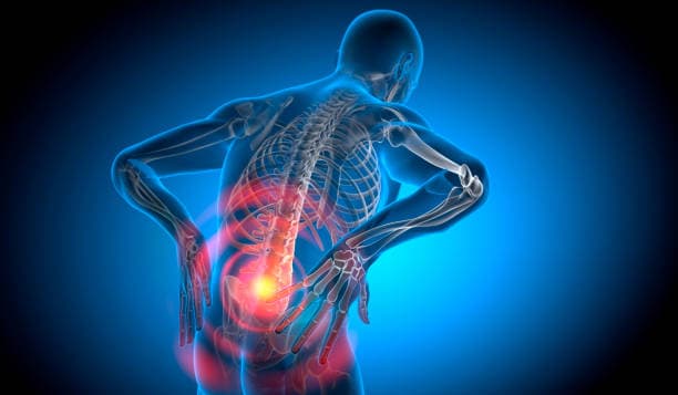 Low back pain