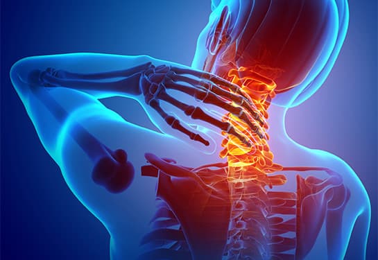 Neck pain