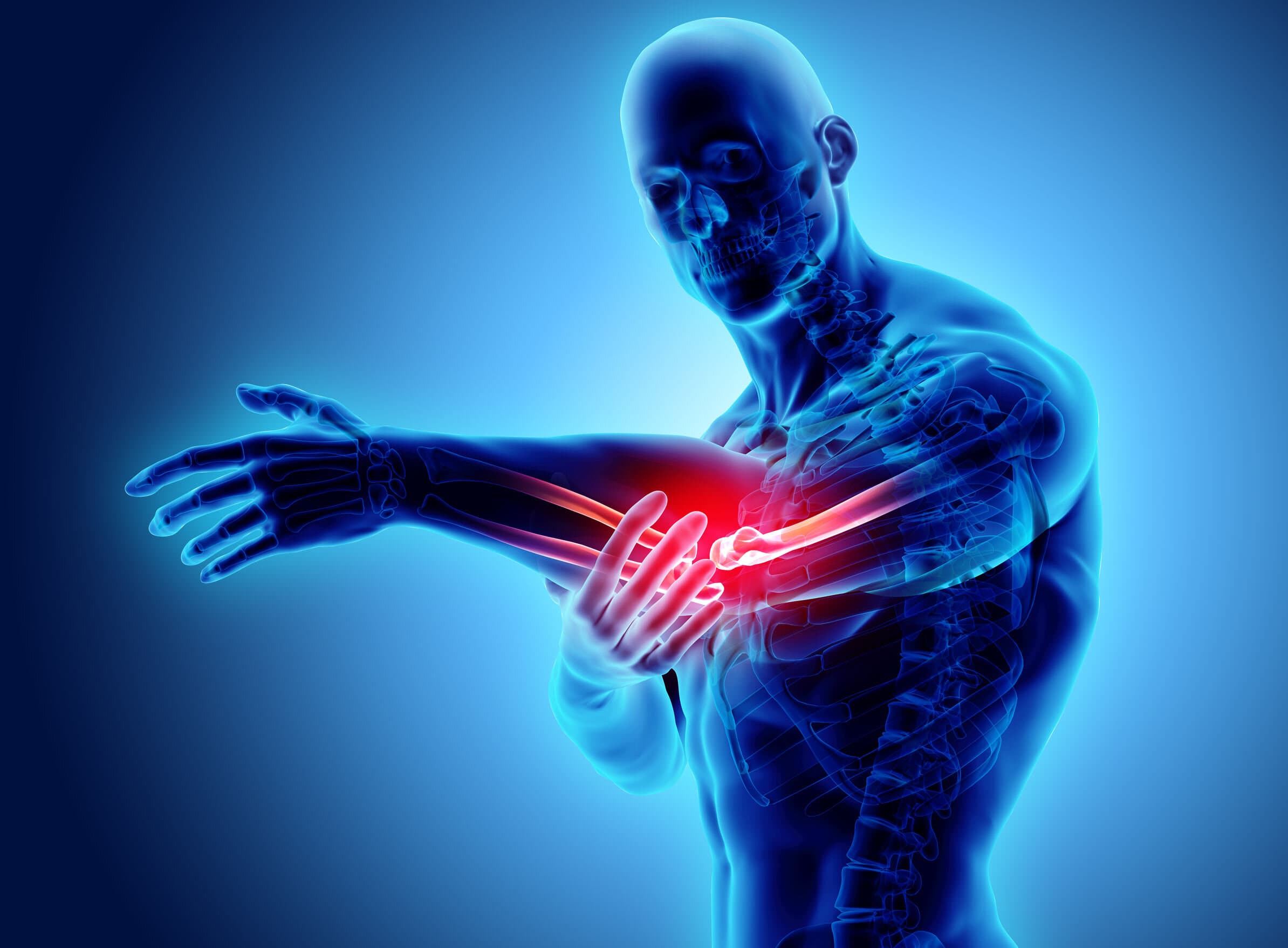Tennis/golf elbow